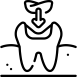 dental tooth filling and cavity